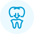 詰め物・被せ物