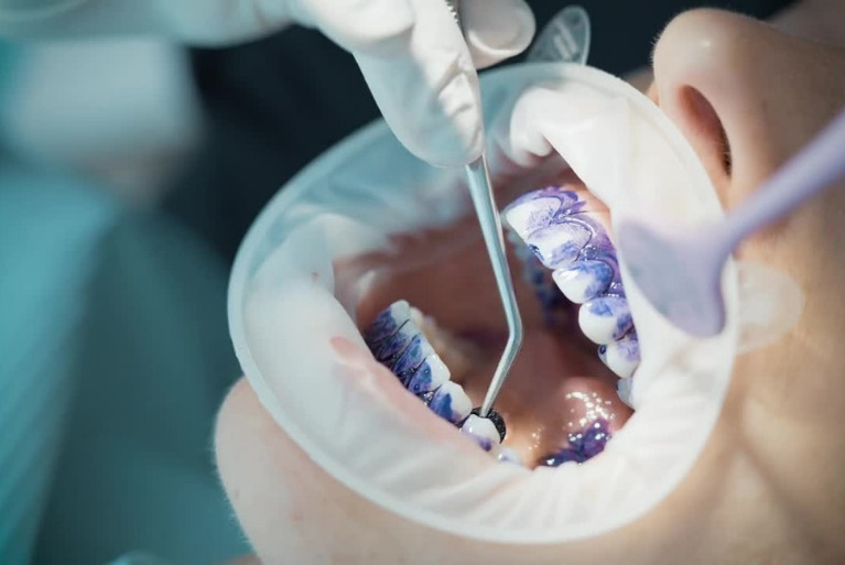 バイオフィルムの可視化