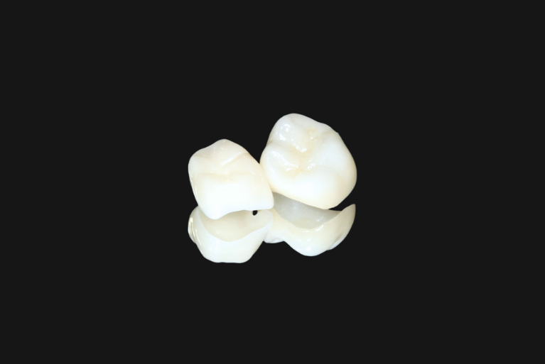 ジルコニアクラウン