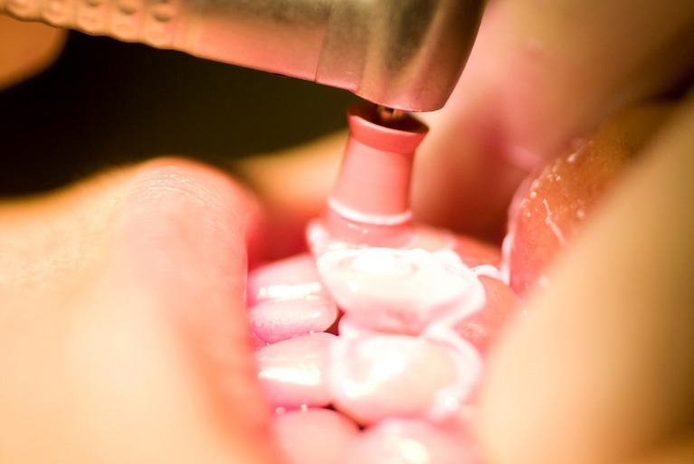 プロフェッショナルケア