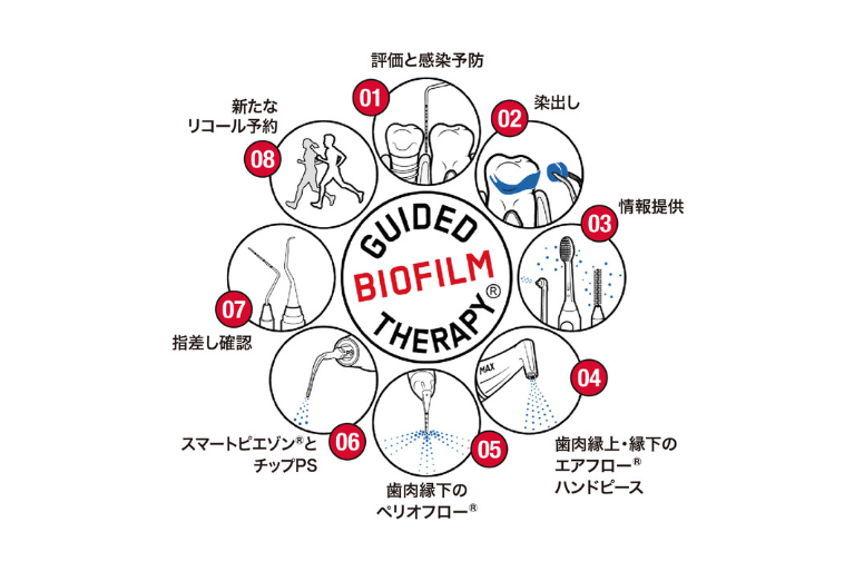 「ただ磨く」から「科学的に守る」へ。スイス生まれの次世代型の予防治療。