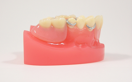 入れ歯（義歯）